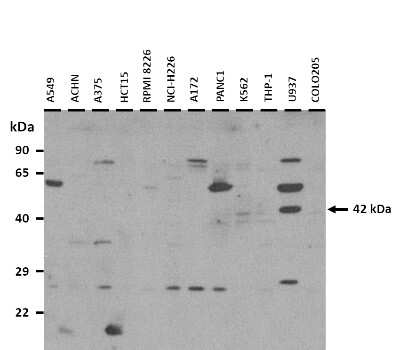 Western Blot: NEU2 Antibody [NBP3-10993] - 25 ug of the indicated Human whole cell extracts was loaded onto a 12% SDS-PAGE gel. 3ug/mL of the antibody was used in this experiment.